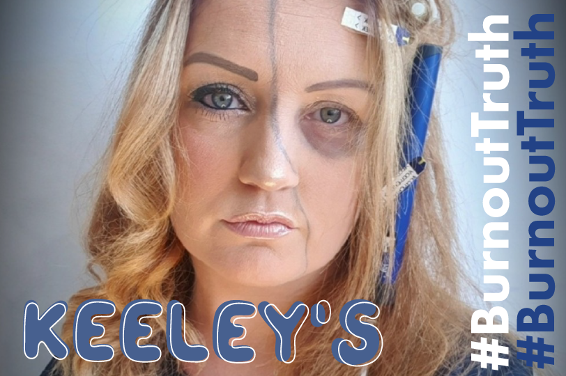 #BURNOUTTRUTH: KEELEY'S STORY (T1D MUM)